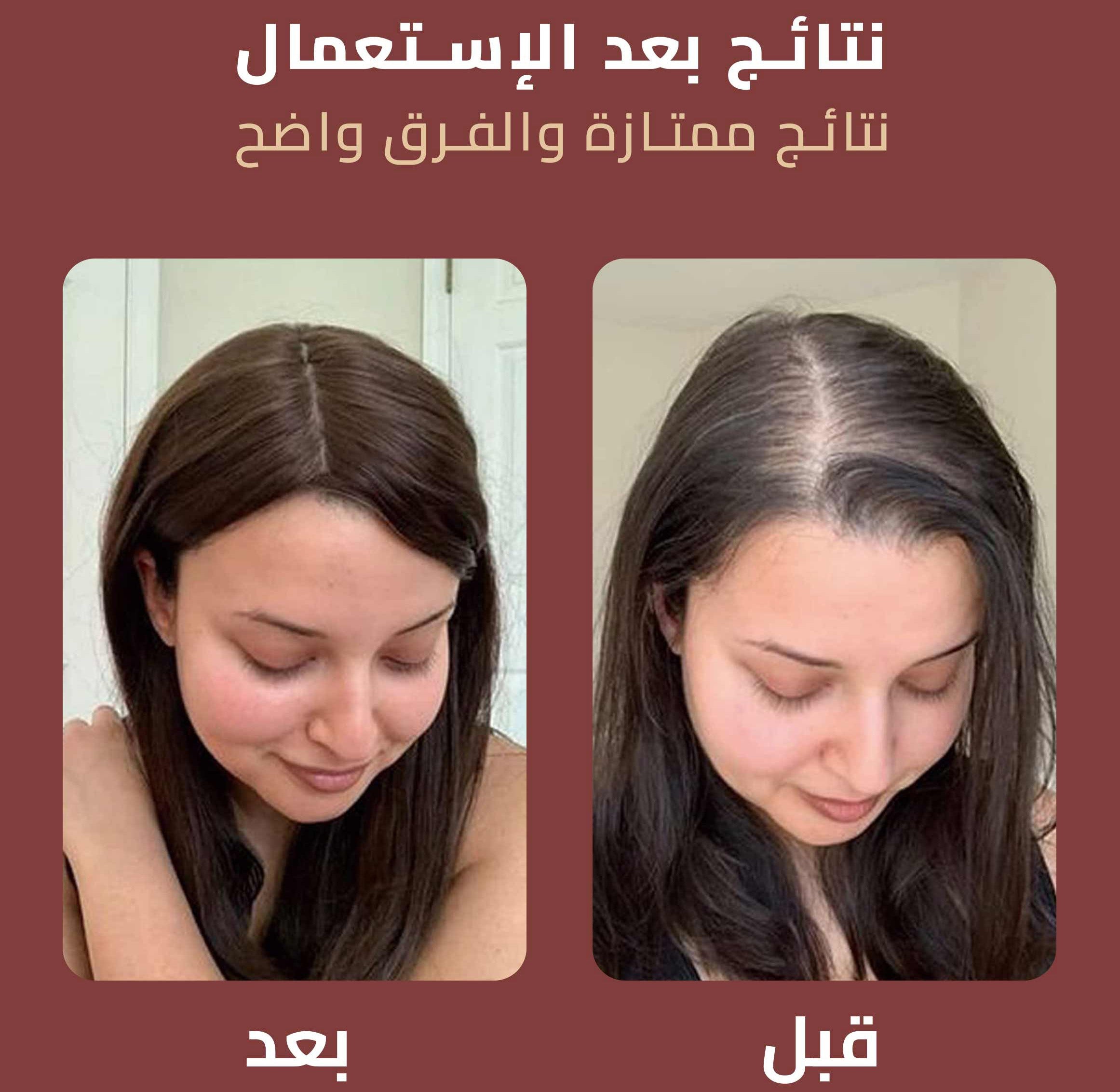 قاعدة الشعر: السر وراء الشعر المثالي والأنيق Pack B